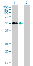 Western blot of MEIS2 expression in transfected 293T cell line by MEIS2 monoclonal antibody (M01), clone 1H4.
