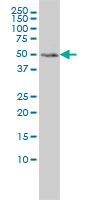 MEIS2 monoclonal antibody (M01), clone 1H4 Western blot of MEIS2 expression in HeLa.