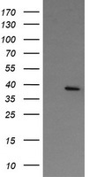 HEK293T cells were transfected with the pCMV6-ENTRY control (Left lane) or pCMV6-ENTRY NUDT9 (Right lane) cDNA for 48 hrs and lysed. Equivalent amounts of cell lysates (5 ug per lane) were separated by SDS-PAGE and immunoblotted with anti-NUDT9.
