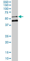 MEIS2 monoclonal antibody (M01), clone 1H4. Western blot of MEIS2 expression in K-562.
