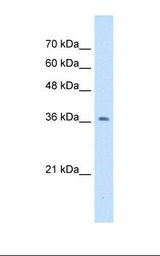 HepG2 cell lysate. Antibody concentration: 1.0 ug/ml. Gel concentration: 12%.