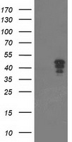 HEK293T cells were transfected with the pCMV6-ENTRY control (Left lane) or pCMV6-ENTRY NUDT9 (Right lane) cDNA for 48 hrs and lysed. Equivalent amounts of cell lysates (5 ug per lane) were separated by SDS-PAGE and immunoblotted with anti-NUDT9.