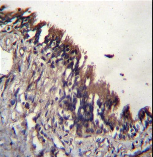 NUDT9 Antibody immunohistochemistry of formalin-fixed and paraffin-embedded human lung tissue followed by peroxidase-conjugated secondary antibody and DAB staining.