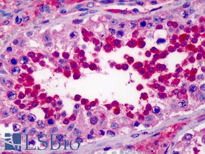 Anti-NUDT9 antibody IHC of human testis. Immunohistochemistry of formalin-fixed, paraffin-embedded tissue after heat-induced antigen retrieval. Antibody LS-B988 concentration 2.5 ug/ml.