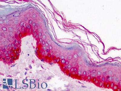 Anti-NUDT9 antibody IHC of human skin. Immunohistochemistry of formalin-fixed, paraffin-embedded tissue after heat-induced antigen retrieval. Antibody LS-B988 concentration 2.5 ug/ml.