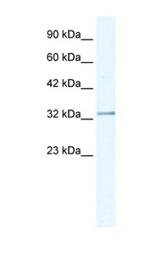 NUDT9 antibody LS-B988 Western blot of Jurkat lysate.