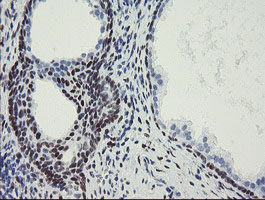 IHC of paraffin-embedded Human prostate tissue using anti-MEIS3 mouse monoclonal antibody. (Heat-induced epitope retrieval by 10mM citric buffer, pH6.0, 100C for 10min).
