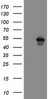 HEK293T cells were transfected with the pCMV6-ENTRY control (Left lane) or pCMV6-ENTRY MEIS3 (Right lane) cDNA for 48 hrs and lysed. Equivalent amounts of cell lysates (5 ug per lane) were separated by SDS-PAGE and immunoblotted with anti-MEIS3.