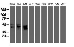 Western blot of extracts (35ug) from 9 different cell lines by using anti-MEIS3 monoclonal antibody (HepG2: human; HeLa: human; SVT2: mouse; A549: human; COS7: monkey; Jurkat: human; MDCK: canine; PC12: rat; MCF7: human).