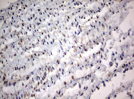 IHC of paraffin-embedded Human muscle tissue using anti-NUMB mouse monoclonal antibody. (Heat-induced epitope retrieval by 10mM citric buffer, pH6.0, 120°C for 3min).