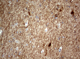 IHC of paraffin-embedded Human adult heart tissue using anti-NUMB mouse monoclonal antibody. (Heat-induced epitope retrieval by 10mM citric buffer, pH6.0, 120°C for 3min).