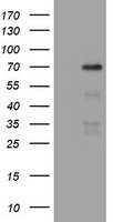 HEK293T cells were transfected with the pCMV6-ENTRY control (Left lane) or pCMV6-ENTRY NUMB (Right lane) cDNA for 48 hrs and lysed. Equivalent amounts of cell lysates (5 ug per lane) were separated by SDS-PAGE and immunoblotted with anti-NUMB.