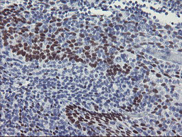 IHC of paraffin-embedded Human tonsil using anti-MEIS3 mouse monoclonal antibody.