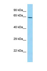 NUMB antibody LS-C146526 Western blot of Mouse Brain lysate. Antibody concentration 1 ug/ml.