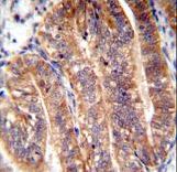 NUMB Antibody immunohistochemistry of formalin-fixed and paraffin-embedded human uterus tissue followed by peroxidase-conjugated secondary antibody and DAB staining.