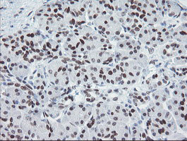IHC of paraffin-embedded Human pancreas tissue using anti-MEIS3 mouse monoclonal antibody.