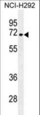 NUMB Antibody western blot of NCI-H292 cell line lysates (35 ug/lane). The NUMB antibody detected the NUMB protein (arrow).