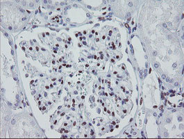 IHC of paraffin-embedded Human Kidney tissue using anti-MEIS3 mouse monoclonal antibody.