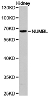 Western blot of extracts of kidney cell lines, using NUMBL antibody.