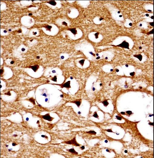 NUMBL Antibody immunohistochemistry of formalin-fixed and paraffin-embedded human brain tissue followed by peroxidase-conjugated secondary antibody and DAB staining.