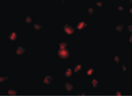 Immunofluorescence of NUP107 in A549 cells with NUP107 antibody at 10 ug/ml.