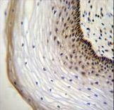 NUP107 Antibody immunohistochemistry of formalin-fixed and paraffin-embedded human cervical tissue followed by peroxidase-conjugated secondary antibody and DAB staining.