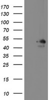 HEK293T cells were transfected with the pCMV6-ENTRY control (Left lane) or pCMV6-ENTRY MEIS3 (Right lane) cDNA for 48 hrs and lysed. Equivalent amounts of cell lysates (5 ug per lane) were separated by SDS-PAGE and immunoblotted with anti-MEIS3.