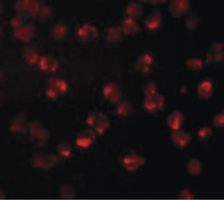 Immunofluorescence of NUP107 in A549 cells with NUP107 antibody at 10 ug/ml.