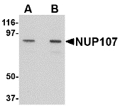 Western blot of NUP107 in A549 cell lysate with NUP107 antibody at (A) 1 and (B) 2 ug/ml.