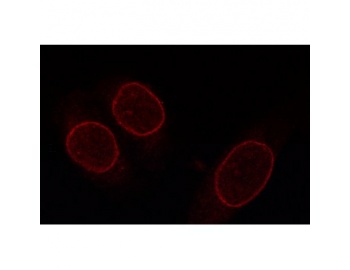 Immunofluorescence showing Nup 153 in HeLa cells
