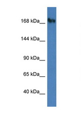 NUP153 antibody LS-C145463 Western blot of Fetal Lung lysate. Antibody concentration 1 ug/ml.
