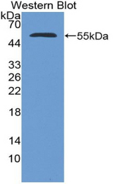 Western blot of recombinant NUP153.