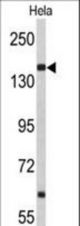 Western blot of NUP153 Antibody in HeLa cell line lysates (35 ug/lane). NUP153 (arrow) was detected using the purified antibody.