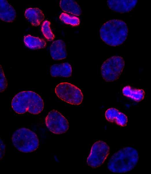 Detection of Human NUP153 by Immunocytochemistry. Sample: NBF-fixed asynchronous HeLa cells. Antibody: Affinity purified rabbit anti-NUP153 used at a dilution of 1:250. Detection: Red-fluorescent goat anti-rabbit IgG highly cross-adsorbed Antibody Hilyte Plus 555 (A120-501E) used at a dilution of 1:100.