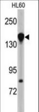 Western blot of NUP155 antibody in HL60 cell line lysates (35 ug/lane). NUP155 (arrow) was detected using the purified antibody.