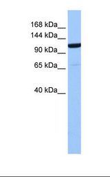 721_B cell lysate. Antibody concentration: 1.0 ug/ml. Gel concentration: 6%-18%.