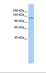 Jurkat cell lysate. Antibody concentration: 1.0 ug/ml. Gel concentration: 6-18%.