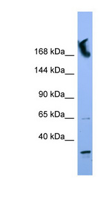 NUP155 antibody LS-C135297 Western blot of HT1080 cell lysate.