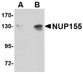 Western blot of NUP155 in P815 cell lysate with NUP155 antibody at (A) 0.5 and (B) 1 ug/ml.