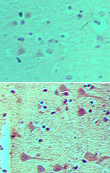 IHC of NUP160 in formalin-fixed, paraffin-embedded human brain tissue using preimmune sera (top) and LS-C148559 (bottom) at 1:100.