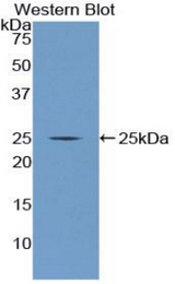 Western blot of recombinant NUP160.