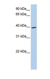 Fetal liver lysate. Antibody concentration: 1.0 ug/ml. Gel concentration: 12%.