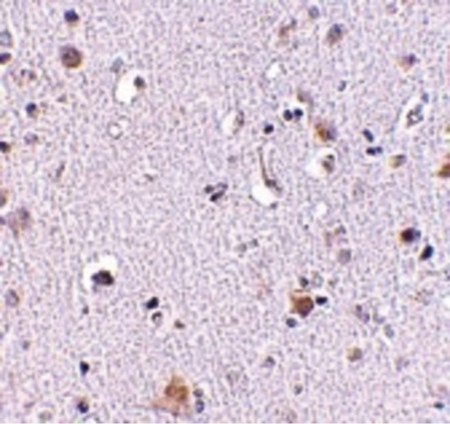 Immunohistochemistry of NUP160 in human brain tissue with NUP160 antibody at 2.5 ug/ml.