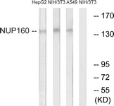 Western blot of extracts from NIH-3T3/A549/HepG2 cells, using NUP160 Antibody. The lane on the right is treated with the synthesized peptide.