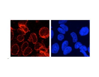 Immunocytochemistry/ Immunofluorescence - GP210 antibody on formaldehyde fixed HeLa cells