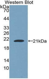 Western blot of recombinant NUP210 / gp210.