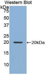 Western blot of recombinant NUP210 / gp210.