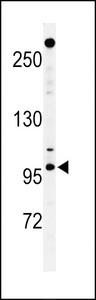 Western blot of NUP210 Antibody in T47D cell line lysates (35 ug/lane). NUP210 (arrow) was detected using the purified antibody.