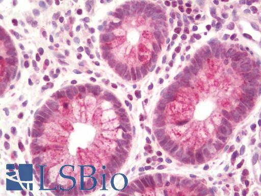 Human Colon: Formalin-Fixed, Paraffin-Embedded (FFPE)