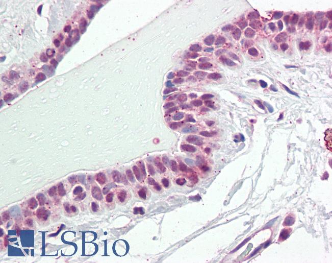 Anti-NUP210 / gp210 antibody IHC staining of human breast. Immunohistochemistry of formalin-fixed, paraffin-embedded tissue after heat-induced antigen retrieval. Antibody LS-B9647 dilution 1:100.